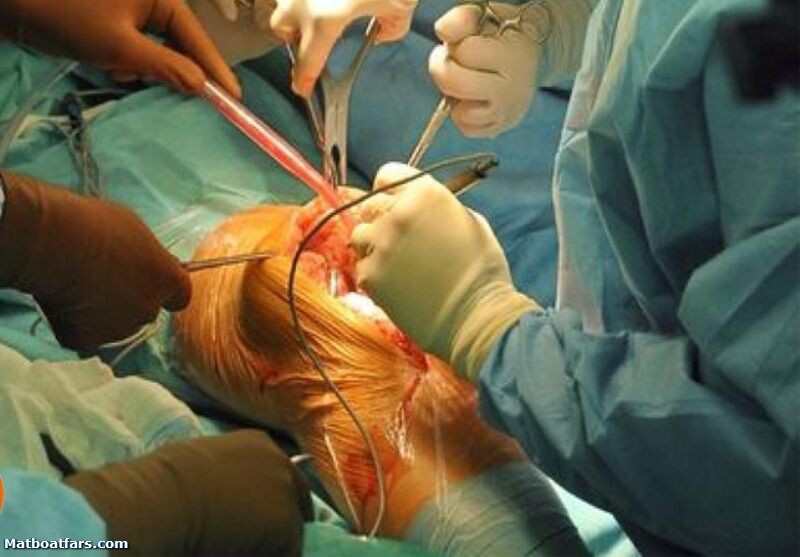 عمل جراحی تعویض همزمان مفصل ۲ زانو با تعرفه دولتی در داراب