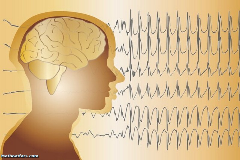 امکان بهبود بیماران صرع در ایران وجود دارد